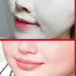 Carotone Body Skin Care