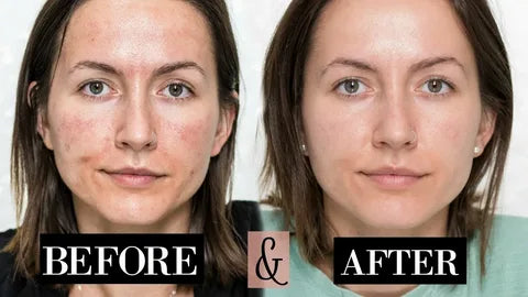 image comparison before